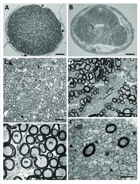 | Myelinated and unmyelinated axons in the olfactory tract and optic ...