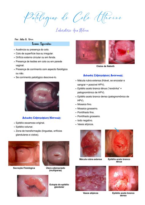 SOLUTION Patologias Do Colo Uterino Ana Helena Studypool