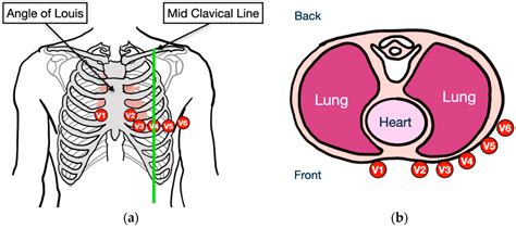 ekg electrode placement ecg lead placement stock illustrations