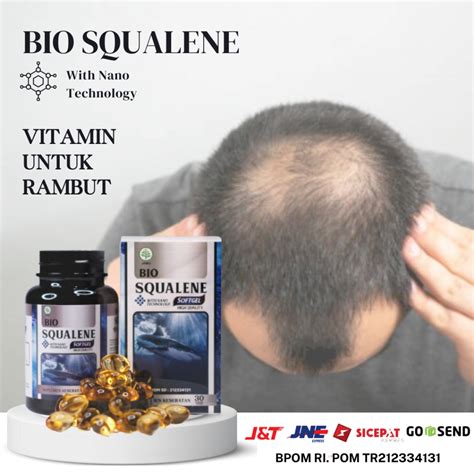 Jual Obat Untuk Penumbuh Rambut Pitak Di Kepala Karena Infeksi Jamur