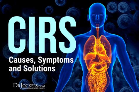 CIRS: Causes, Symptoms and Solutions - DrJockers.com