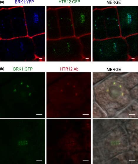 BRK1 Colocalises With The Centromeric Histone 3 Variant HTR12 In