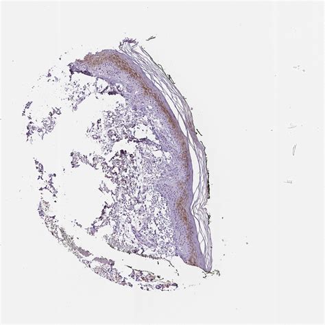 Tissue Expression Of Apoe Staining In Skin The Human Protein Atlas