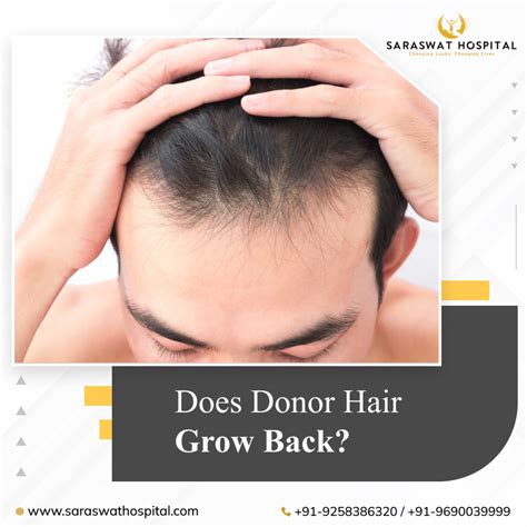 Does Donor Hair Grow Back after FUE Hair Transplant in India?