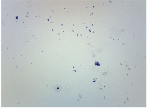 Streptococcus Pneumoniae Gram Stain