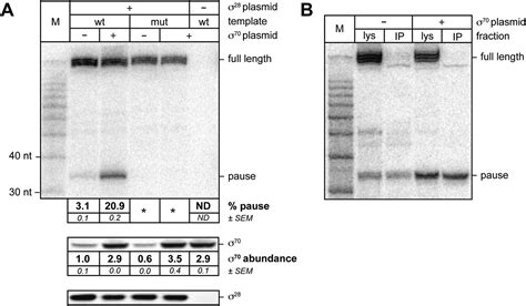 Figures And Data In The Primary Factor In Escherichia Coli Can Access