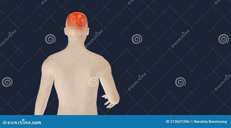 Headache Brain System Problems Skull Pain Face Man Showing Headaches D