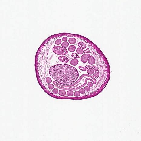 Ascaris Lumbricoides Microscope