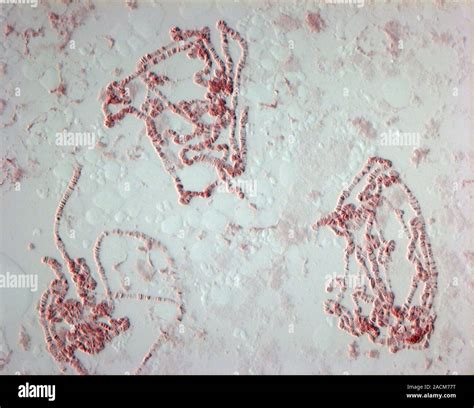 Riesige Chromosomen Licht schliffbild Diese riesigen polytäne