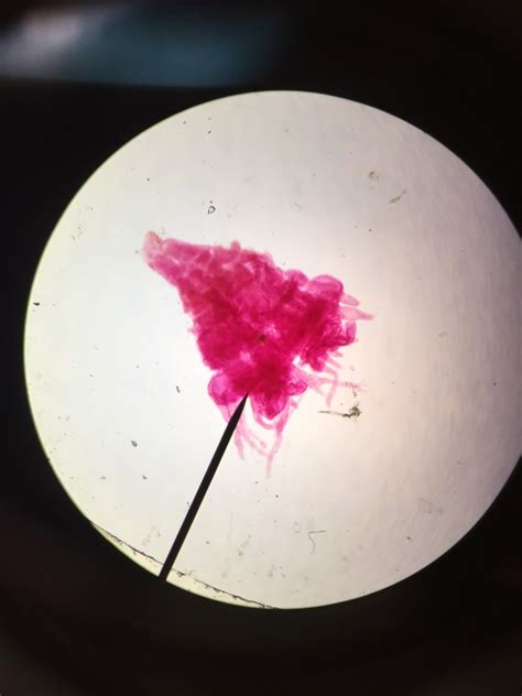 PHYLUM CNIDARIA Scyphozoa Part 1 Diagram Quizlet