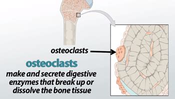 Osteoclast: Definition, Function & Formation - Video & Lesson ...