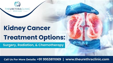 Kidney Cancer Treatment Options: Surgery, Radiation, and Chemotherapy