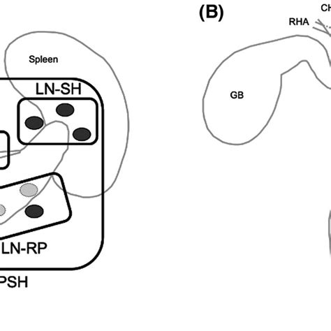 A Schematic Illustration Of The Lymph Node Stations Dissected During Download Scientific