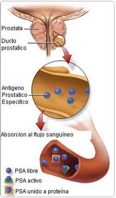 Psa El Ant Geno Prost Tico Espec Fico