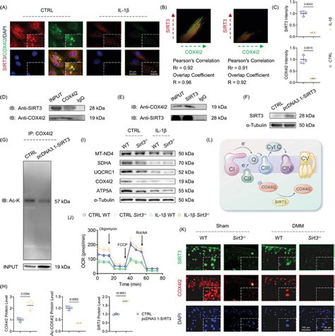 Sirt Targeted And Deacetylated Cox I In Mitochondria In A