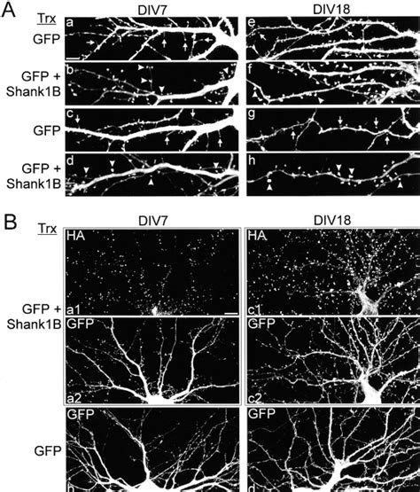 Regulation Of Dendritic Spine Morphology And Synaptic Function By Shank