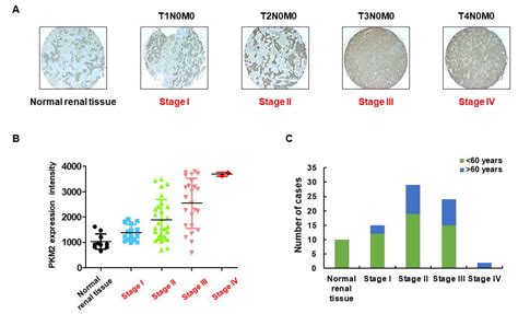 Ijms Free Full Text Knockdown Of Pyruvate Kinase M2 Inhibits Cell