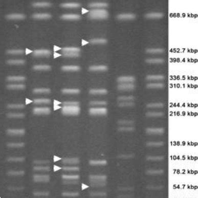 Pulsed Field Gel Electrophoresis Profiles Exhibited By The Salmonella