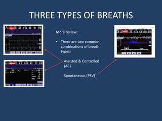 Mechancial Ventilation Part One PPT