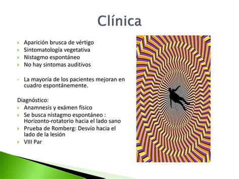 Neuritis Vestibular Una Patolog A Que Afecta Al Nervio Vestibular Ppt