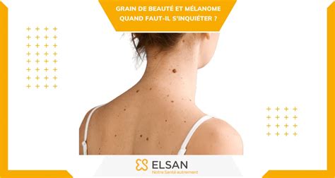 Grain De Beaut Et Cancer Les Informations Retenir