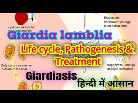 Giardia Lamblia Life Cycle Pathogenesis Lab Diagnosis And Treatment