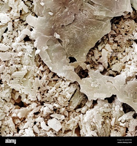 Gypsum Crystals Coloured Scanning Electron Micrograph SEM Of