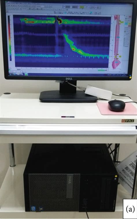 High Resolution Manometry Hrm System Hrm Was Performed Using A A