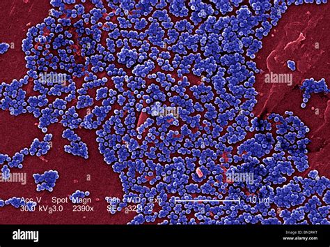 Scanning Electron Micrograph Sem Of Methicillin Resistant