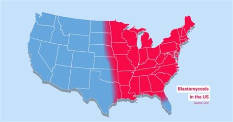 Maps Show Where Deadly Fungal Diseases Are Surging Across The Us Us