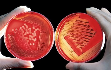 Streptococcus pyogenes: the clot buster - The Microbial Menagerie