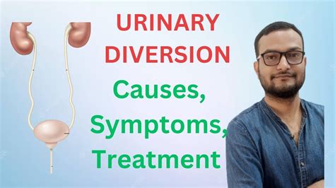 Urinary Diversion Cause Symptoms Diagnosis And Treatment Ep22 Youtube