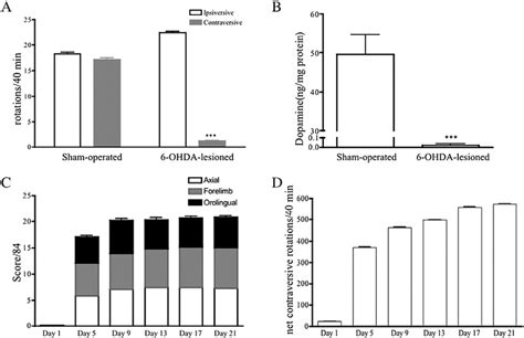 Assessment Of Parkinsonism And L Dopa Induced Dyskinesia A