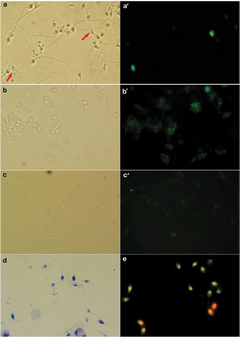 Sperm Ubiquitination As Shown By Light And Immunofluorescence Download Scientific Diagram