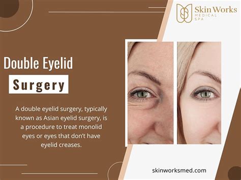 Double Eyelid Surgery - skinworksmed Photo (44726706) - Fanpop