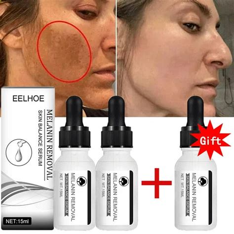 Suero Antienvejecimiento Para Eliminar Manchas Oscuras Crema