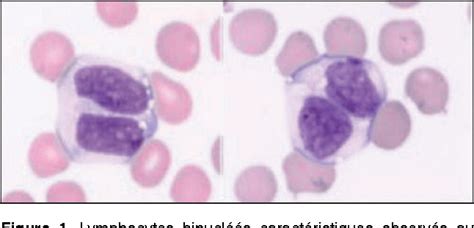 Figure 1 From [morphologic Features Of The Binucleated Lymphocytes For The Assesment Of