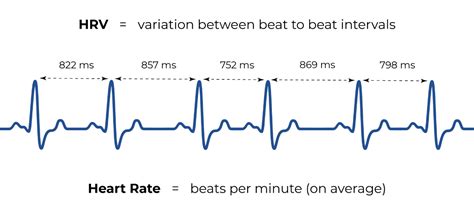 Heart Rate Variability – Does it matter? - Tres Care