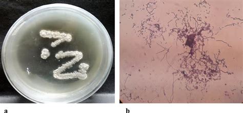 Growth And Colony Morphology Of Actinomycetes Isolate LEP 7 A Isolate