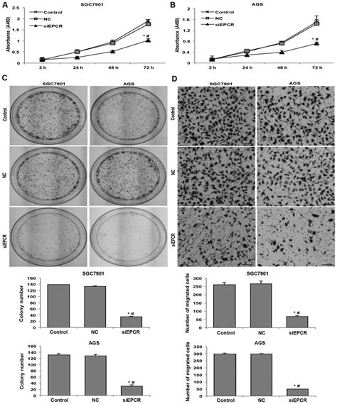 Knockdown Of EPCR Inhibits The Proliferation And Migration Of Human