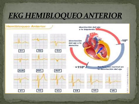 Electrocardiograma PPT Descarga Gratuita