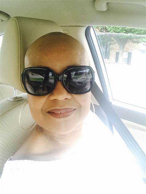 Pin By Lorna Shingenge On My Bald Head Alopecia Square Sunglasses