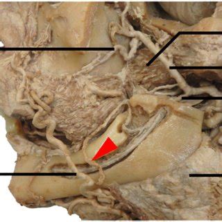 Inferior Alveolar Artery