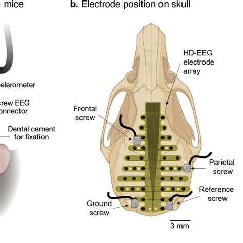 Recording Of EEG A Schematic Illustration Of The Recording