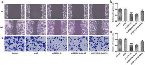 Full Article Dep Domain Containing 1b Depdc1b Exerts The Tumor