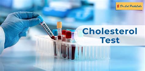 What Is Cholesterol Test Lipid Profile Test Dr Lal Pathlabs Blogs