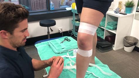 Acl Taping Technique With Physiotherapist Ryan Dorahy Youtube