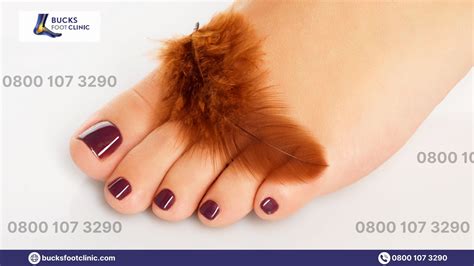 Foot Corn Healing Process At Michael Danforth Blog