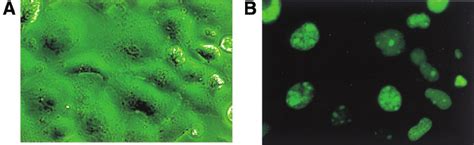 Subcellular Localization Of Mabt1 Cos7 Cells Were Transfected With