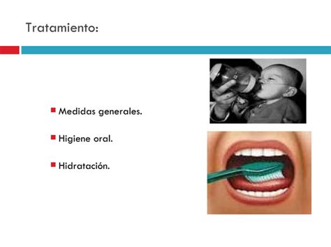 Clase De Glandulas En Orl Ppt